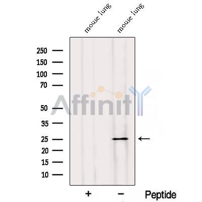 RABL3 Antibody - Western blot analysis of extracts from Mouse lung tissue, using RABL3 Antibody.