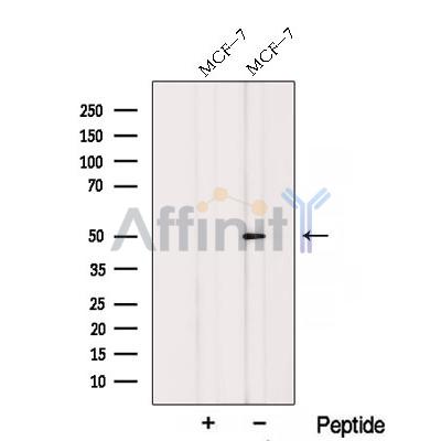 RARG Antibody - Western blot analysis of extracts from MCF-7 cells, using RARG Antibody.