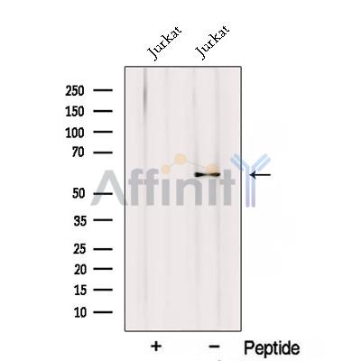 RIC8A Antibody - Western blot analysis of extracts from Jurkat cells, using RIC8A Antibody.