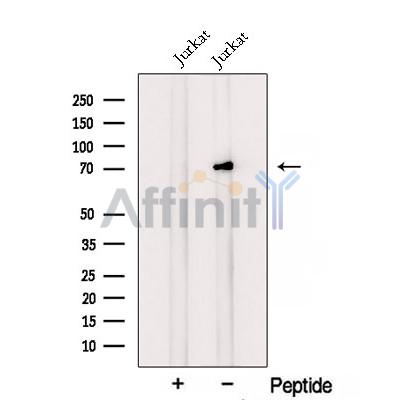 RLIM Antibody - Western blot analysis of extracts from Jurkat cells, using RLIM Antibody.