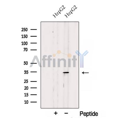 SDHB Antibody - Western blot analysis of extracts from HepG2 cells, using SDHB Antibody.