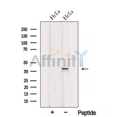 SIRT6 Antibody - Western blot analysis of extracts from HeLa cells, using SIRT6 Antibody.