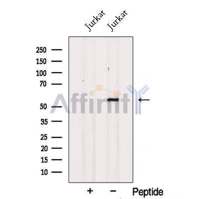 SPTLC1 Antibody - Western blot analysis of extracts from Jurkat cells, using SPTLC1 Antibody.