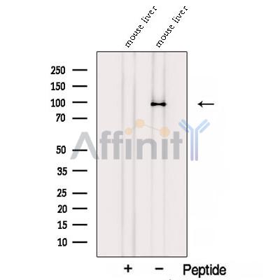 STRA6 Antibody - Western blot analysis of extracts from Mouse liver tissue , using STRA6 Antibody.