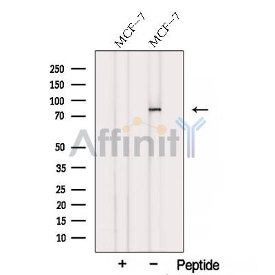 SUZ12 Antibody - Western blot analysis of extracts from MCF-7 cells, using SUZ12 Antibody.