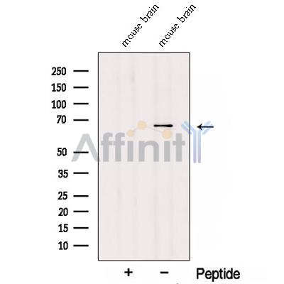 TDRKH Antibody - Western blot analysis of extracts from Mouse brain tissue , using TDRKHspecific Antibody.