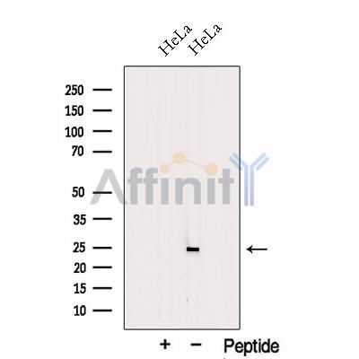 TESC Antibody - Western blot analysis of extracts from HeLa cells, using TESC Antibody.