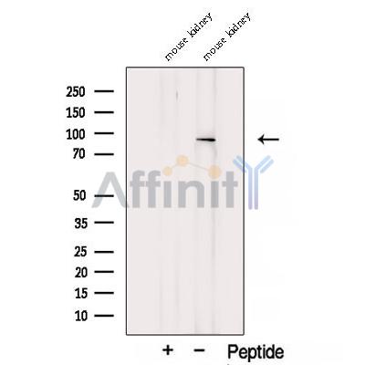TGM1 Antibody - Western blot analysis of extracts from Mouse kidney tissue, using TGM1 Antibody.