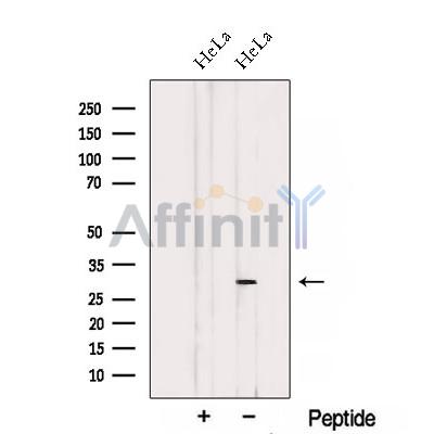 THAP2 Antibody - Western blot analysis of extracts from HeLa cells, using THAP2 Antibody.