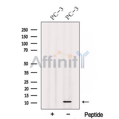 TIMM13 Antibody - Western blot analysis of extracts from PC-3 cells, using TIMM13 Antibody.