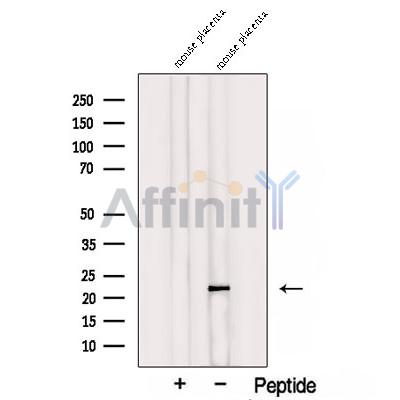 TMEM11 Antibody - Western blot analysis of extracts from Mouse placenta tissue, using TMEM11 Antibody.
