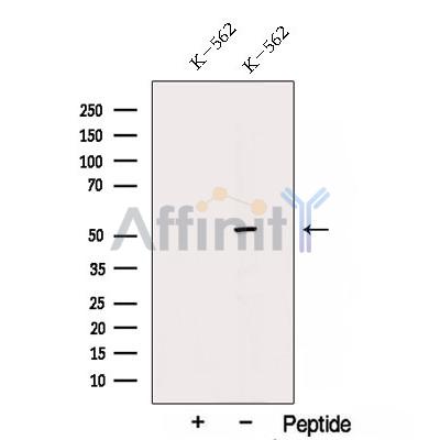 TRIM11 Antibody - Western blot analysis of extracts from K-562 cells, using TRIM11 Antibody.