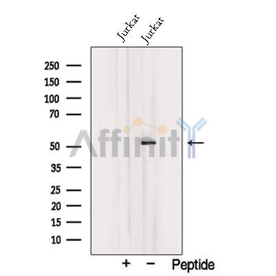 TRIM15 Antibody - Western blot analysis of extracts from Jurkat cells, using TRIM15 Antibody.
