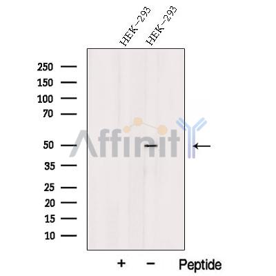 TSP50 Antibody - Western blot analysis of extracts from HEK-293 cells, using TSP50 Antibody.
