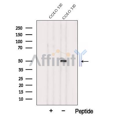 TXNDC5 Antibody - Western blot analysis of extracts from COLO 320 cells, using TXNDC5 Antibody.