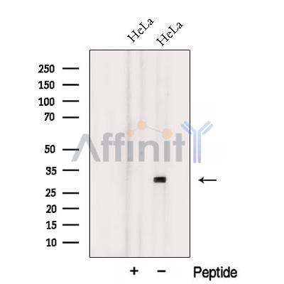 TXNL6 Antibody - Western blot analysis of extracts from HeLa cells, using TXNL6 Antibody.