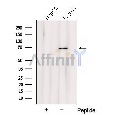 VPS33A Antibody - Western blot analysis of extracts from HepG2 cells, using VPS33A Antibody.