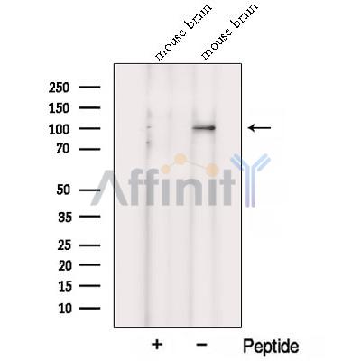 VPS39 Antibody - Western blot analysis of extracts from Mouse brain tissue, using VPS39 Antibody.