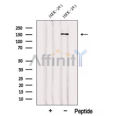 WDR19/IFT144 Antibody - Western blot analysis of extracts from HEK-293 cells, using WDR19/IFT144 Antibody.