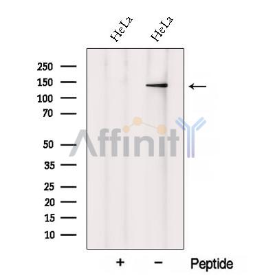 XPO6 Antibody - Western blot analysis of extracts from HeLa cells, using XPO6 Antibody.