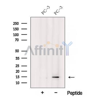 YPEL3 Antibody - Western blot analysis of extracts from PC-3 cells, using YPEL3 Antibody.