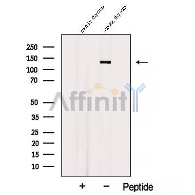 AFAP1L2 Antibody - Western blot analysis of extracts from Mouse thymus tissue, using AFAP1L2 Antibody.