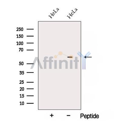 ARIH2 Antibody - Western blot analysis of extracts from HeLa cells, using ARIH2 Antibody.