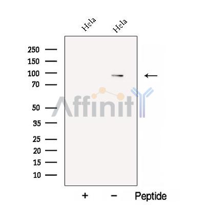 C17orf28 Antibody - Western blot analysis of extracts from Hela cells, using C17orf28 Antibody.