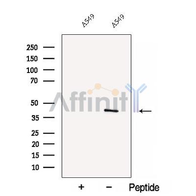 C5orf4 Antibody - Western blot analysis of extracts from  A549 cells, using C5orf4 Antibody.