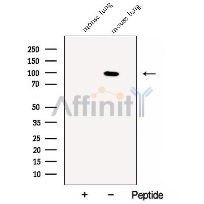 Calmegin Antibody - Western blot analysis of extracts from Mouse lung tissue, using Calmegin Antibody.