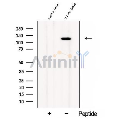 CC2D1B Antibody - Western blot analysis of extracts from Mouse brain tissue, using CC2D1B Antibody.