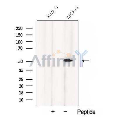 CCM2 Antibody - Western blot analysis of extracts from MCF-7 cells, using CCM2 Antibody.