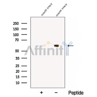 CCT6B Antibody - Western blot analysis of extracts from Mouse ovary  tissue, using CCT6B Antibody.