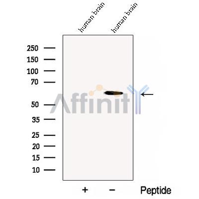 CDR2 Antibody - Western blot analysis of extracts from Human brain tissue, using CDR2 Antibody.
