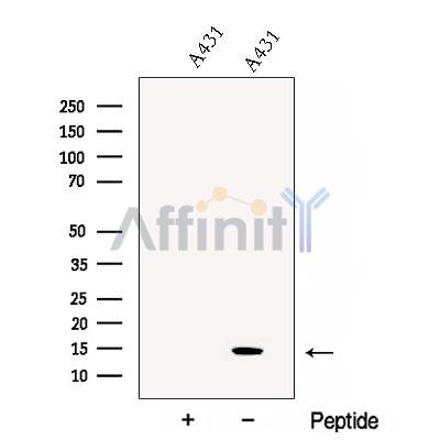 CHCHD10 Antibody - Western blot analysis of extracts from A431 cells, using CHCHD10 Antibody.