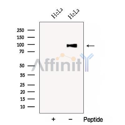 COG3 Antibody - Western blot analysis of extracts from HeLa cells, using COG3 Antibody.