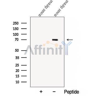 Collagen Type XXIII Antibody - Western blot analysis of extracts from Mouse thymus tissue, using Collagen Type XXIII Antibody.