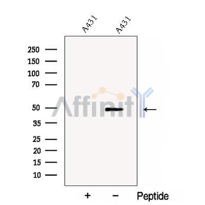 Connexin-46 Antibody - Western blot analysis of extracts from A431 cells, using Connexin-46 Antibody.
