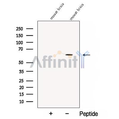 CPNE6 Antibody - Western blot analysis of extracts from Mouse brain tissue, using CPNE6 Antibody.