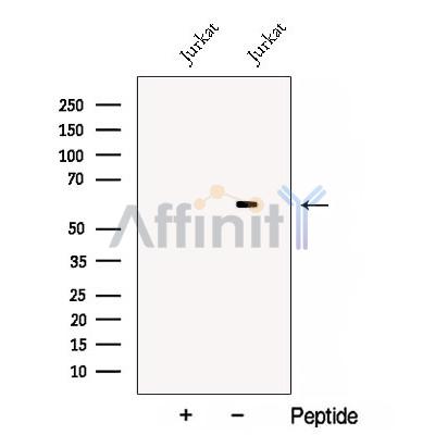 CRMP4 Antibody - Western blot analysis of extracts from Jurkat cells, using CRMP4 Antibody.