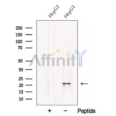 CSRP2 Antibody - Western blot analysis of extracts from HepG2 cells, using CSRP2 Antibody.
