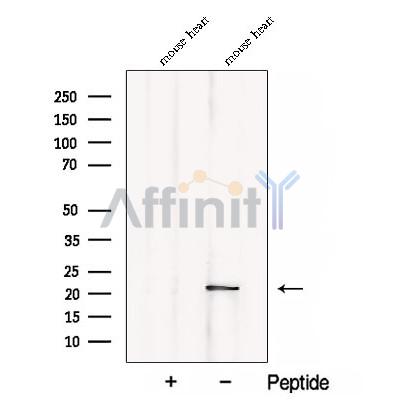 CSRP3 Antibody - Western blot analysis of extracts from Mouse heart tissue, using CSRP3 Antibody.