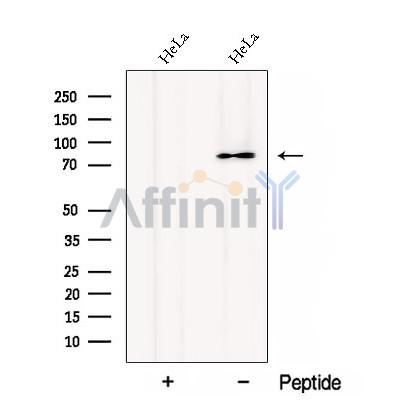 CTAGE1 Antibody - Western blot analysis of extracts from HeLa cells, using CTAGE1 Antibody.