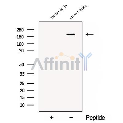 CTTNBP2 Antibody - Western blot analysis of extracts from Mouse brain tissue, using CTTNBP2 Antibody.