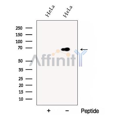 DCP1B Antibody - Western blot analysis of extracts from HeLa cells, using DCP1B Antibody.