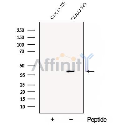 DDAH2 Antibody - Western blot analysis of extracts from COLO 320 cells, using DDAH2 Antibody.