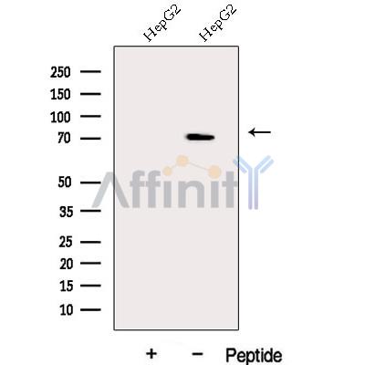DDX43 Antibody - Western blot analysis of extracts from HepG2 cells, using DDX43 Antibody.