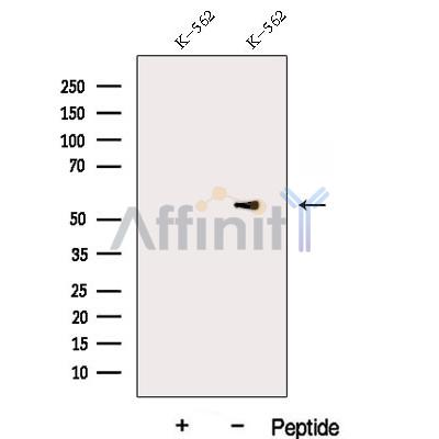 DDX6 Antibody - Western blot analysis of extracts from K-562 cells, using DDX6 Antibody.