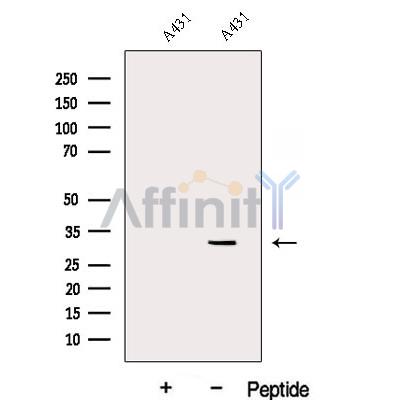 DENR Antibody - Western blot analysis of extracts from A431 cells, using DENR Antibody.