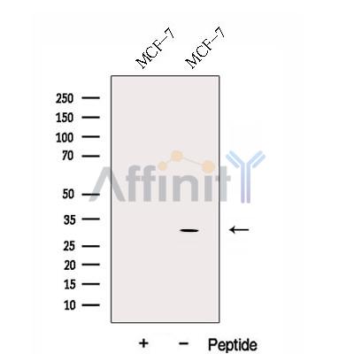 DIO2 Antibody - Western blot analysis of extracts from MCF-7 cells, using DIO2 Antibody.